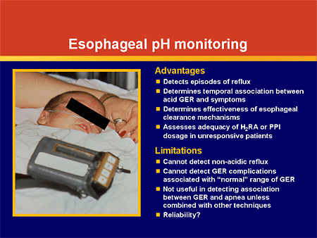 Esophageal pH probe testing is a useful test to assess the frequency of reflux or acid reflux