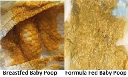 Breastfed and formula poop are different in color in texture. | Your Baby Poop Color Chart Explained | Baby Journey