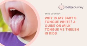 Baby's tongue white milk tongue vs thrush - Baby Journey blog