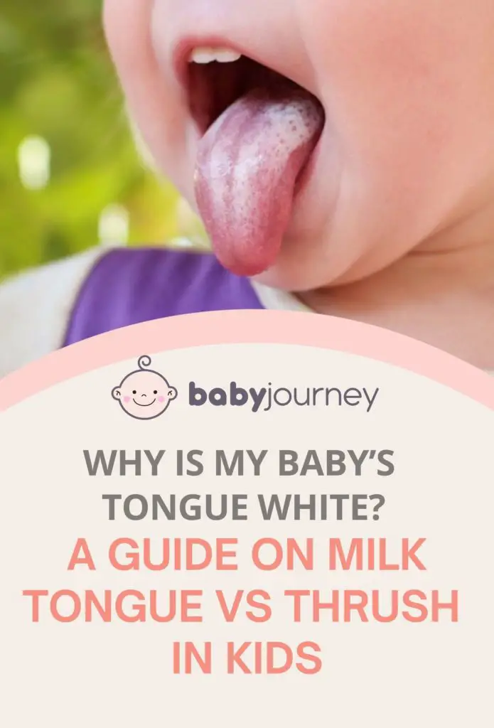 Milk tongue vs thrush white tongue baby - Baby Journey blog