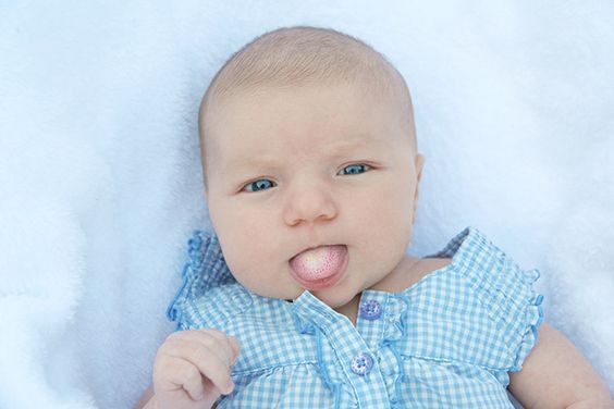 Milk tongue usually occurs after a feeding. - Milk tongue vs thrush - Baby Journey blog