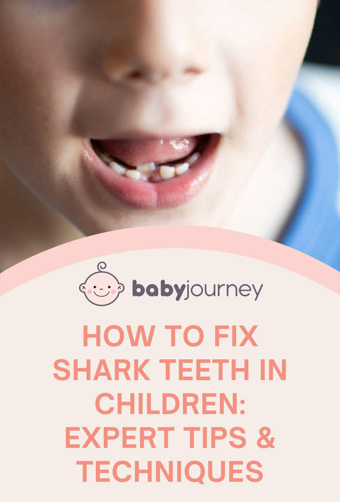 How to Fix Shark Teeth in Children: Expert Tips & Techniques Pinterest Image - Baby Journey 
